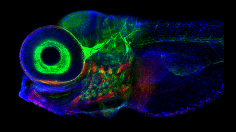 zebrafish brain